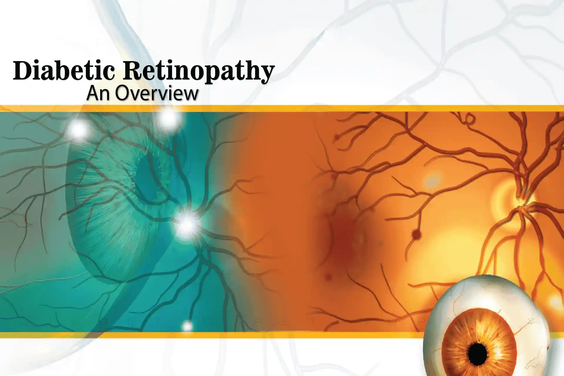 Diabetic Retinopathy